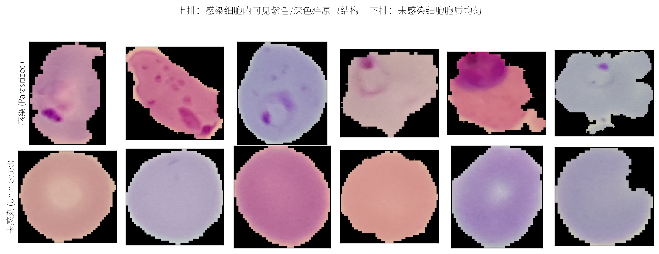 样本：细胞内部的染色斑点是证据